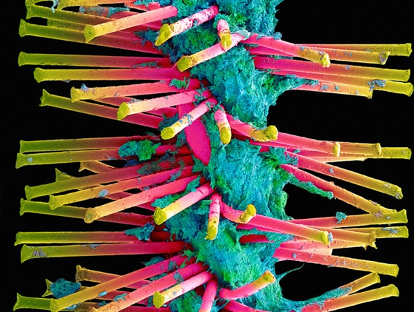 你看过这样的吗?显微镜下的口腔:这么恐怖