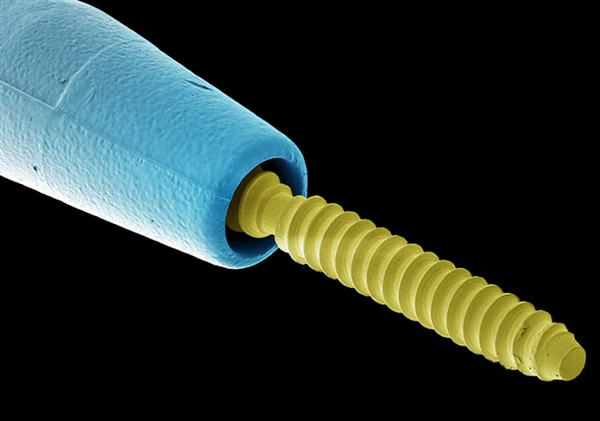 你看过这样的吗?显微镜下的口腔:这么恐怖