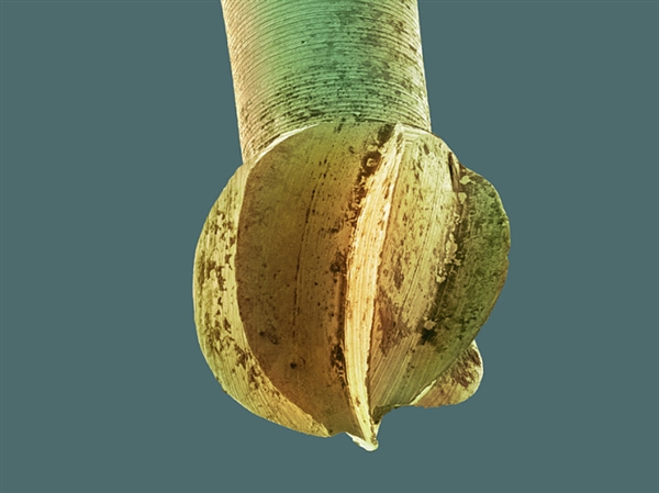 你看过这样的吗?显微镜下的口腔:这么恐怖