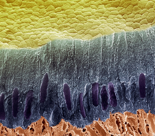 你看过这样的吗?显微镜下的口腔:这么恐怖